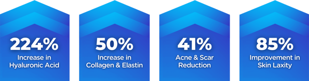 EXION Stats | Skin Rejuvenation | Rizzo Family Medicine